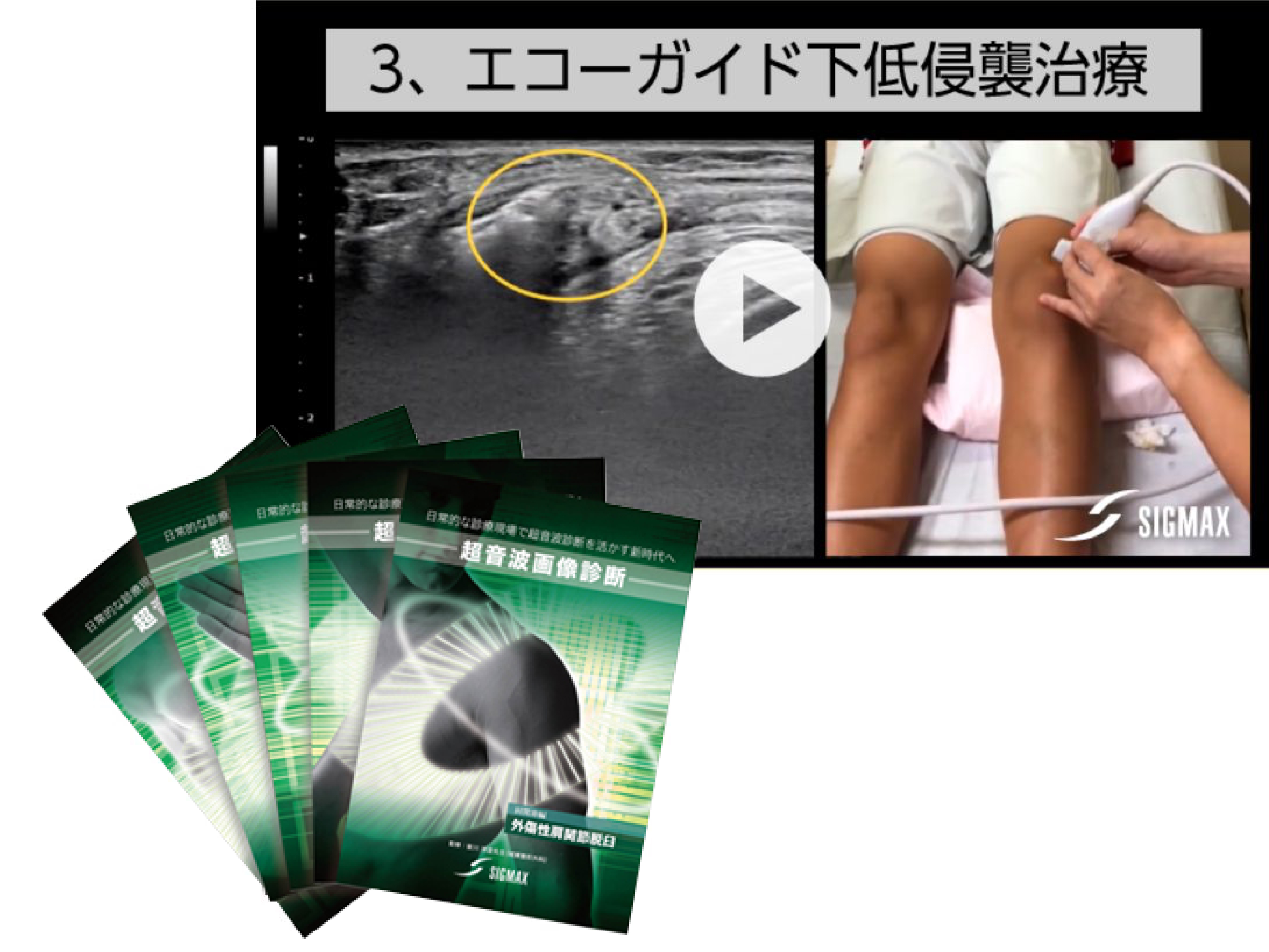据え置き型エコー機器