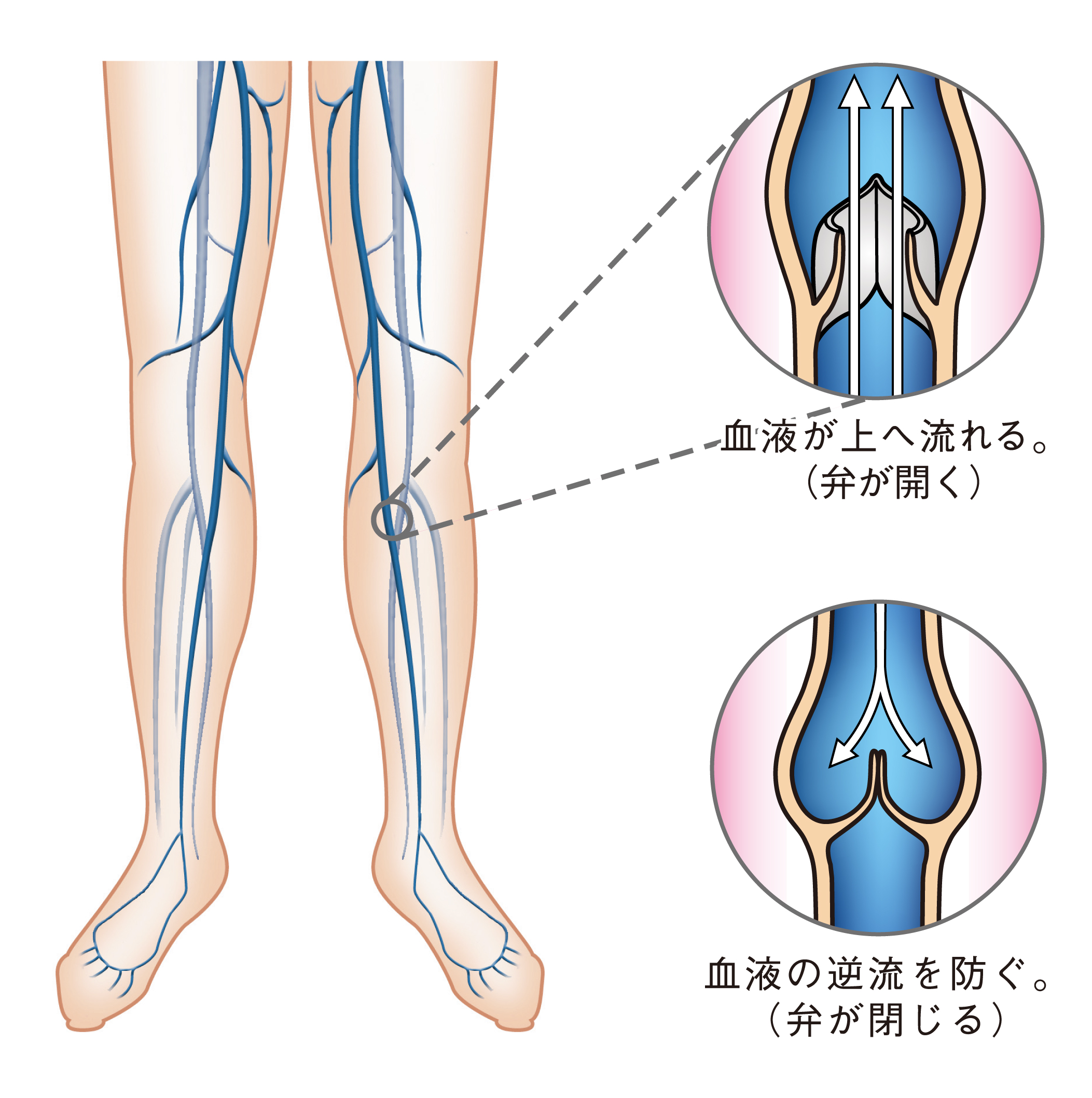 下肢の静脈と弁の慟き