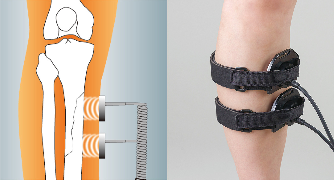 2プローブ　並列