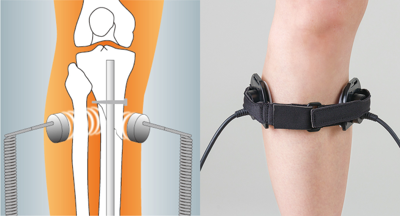 2プローブ　2方向