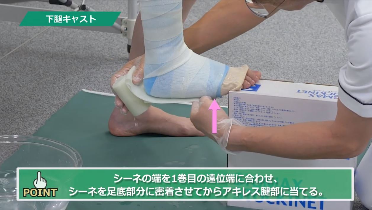 四肢外固定の奥義⑪下腿キャスト