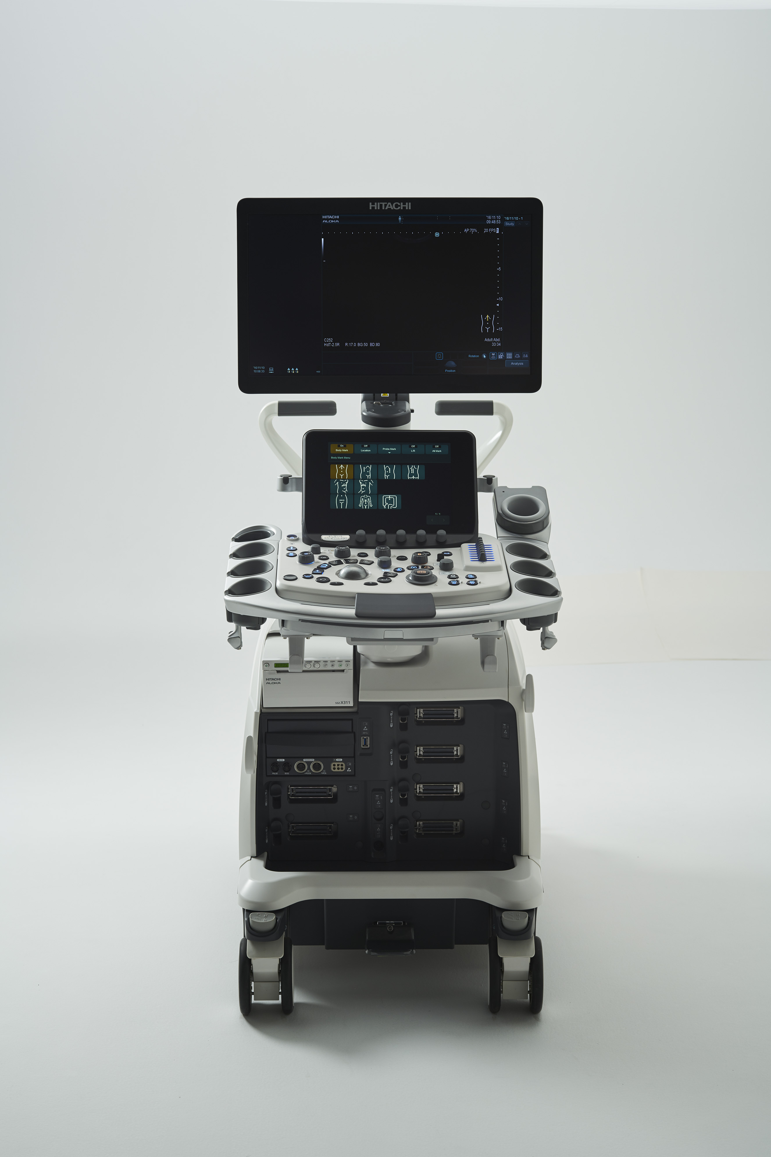 超音波診断装置「ARIETTA 850」