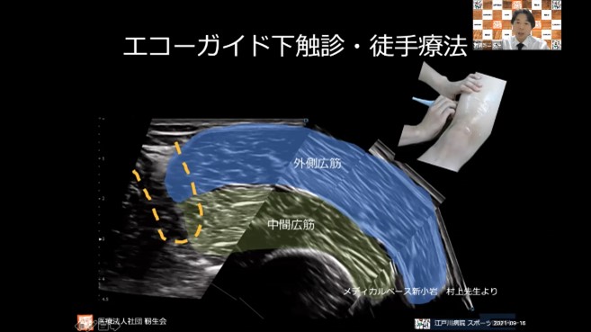 リハビリテーションにおける運動器エコー活用の基礎 ～整形外科クリニック院長／理学療法士の立場から～