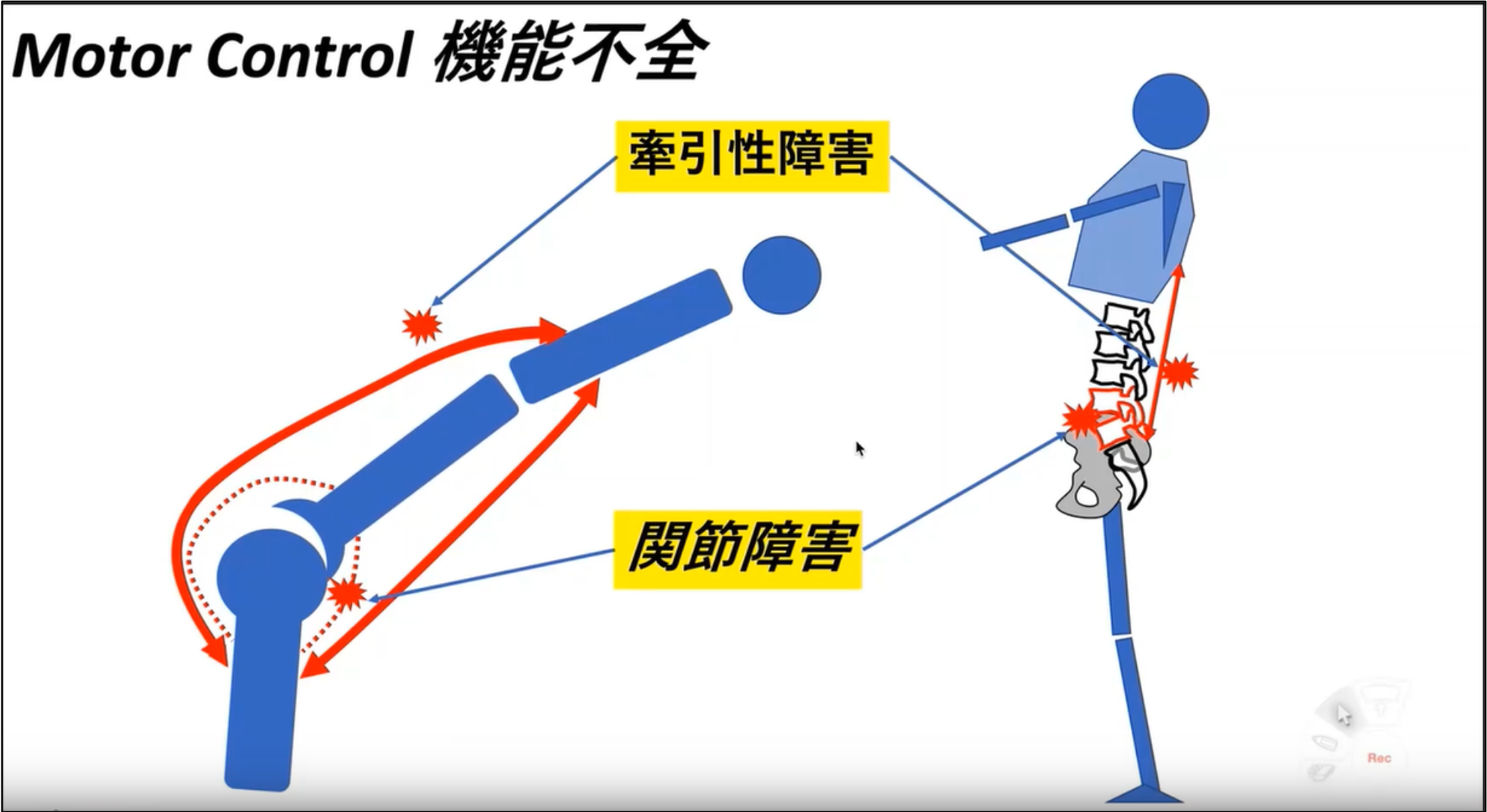 腰痛やロコモティブシンドロームに対する運動療法